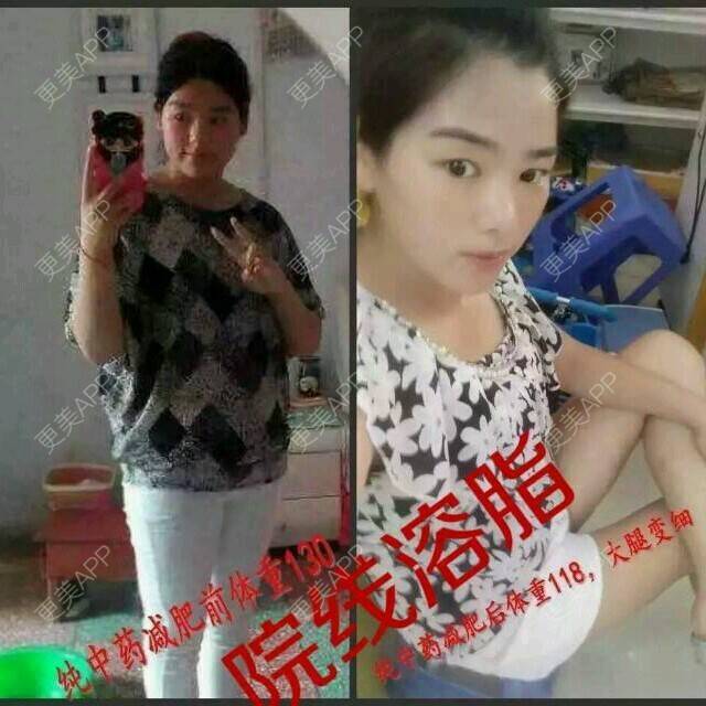 更美 - 一粒瘦3~8斤💊0副作用的经验 | 减肥胶囊 | 佛山