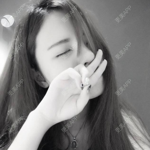更美 - 哈哈baby的隆鼻经验 | 硅胶隆鼻 | 隆鼻 | 美购日记 | 自体软骨垫鼻尖 | 广州