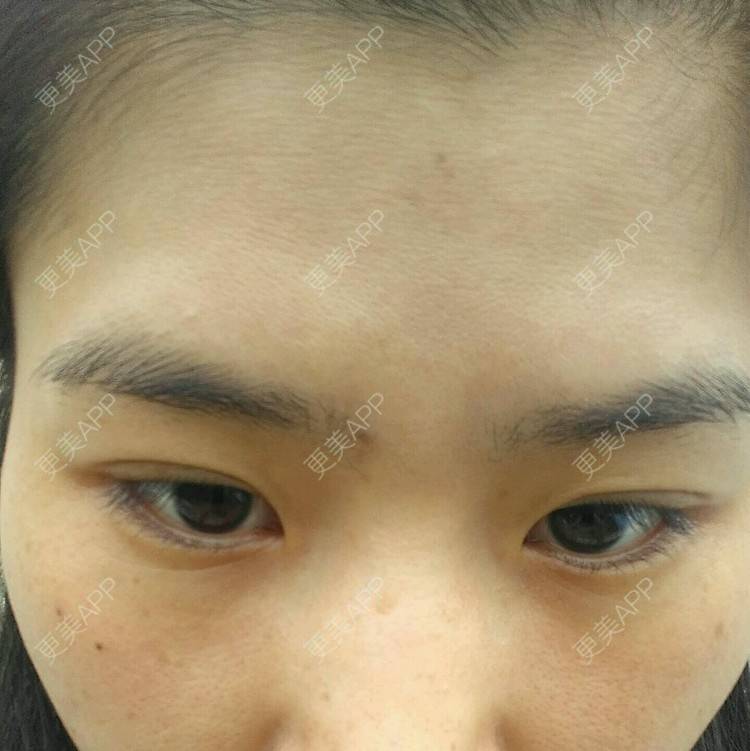 更美 - 苦涩味柚子的经验 | 免费除皱纹