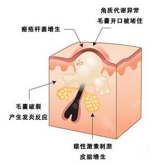 皮肤美容