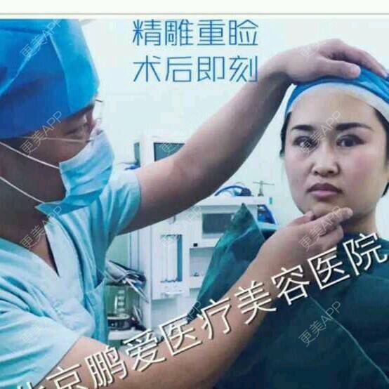 更美 - 北京鹏爱医疗美容诊所的全切双眼皮经验 | 美购日记 | 全切双眼皮 | 北京