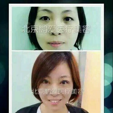 北京鹏爱医疗美容诊所