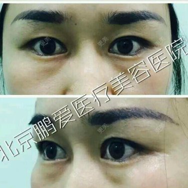 北京鹏爱医疗美容诊所