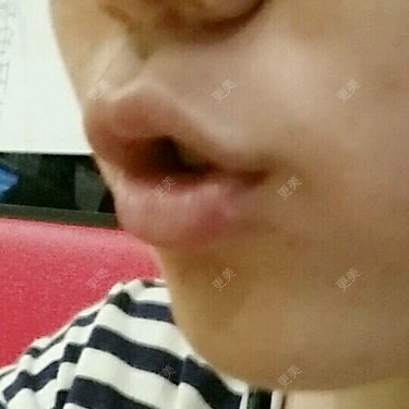 CHY-宇