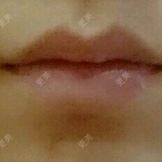 CHY-宇