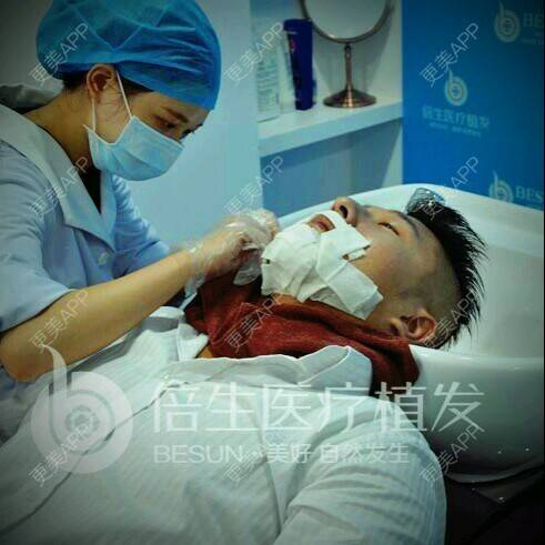 曾浩医生的植胡须日记