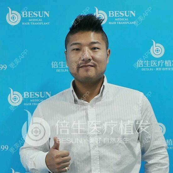 曾浩医生的植胡须日记