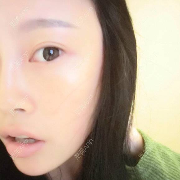 更美 - 更美用户7237075443的水光项目经验 | 水光项目 | 德阳