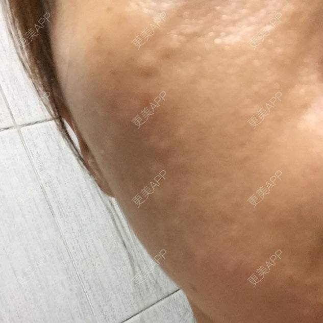 更美 - 更美用户7235483805的经验 | 改善肤质