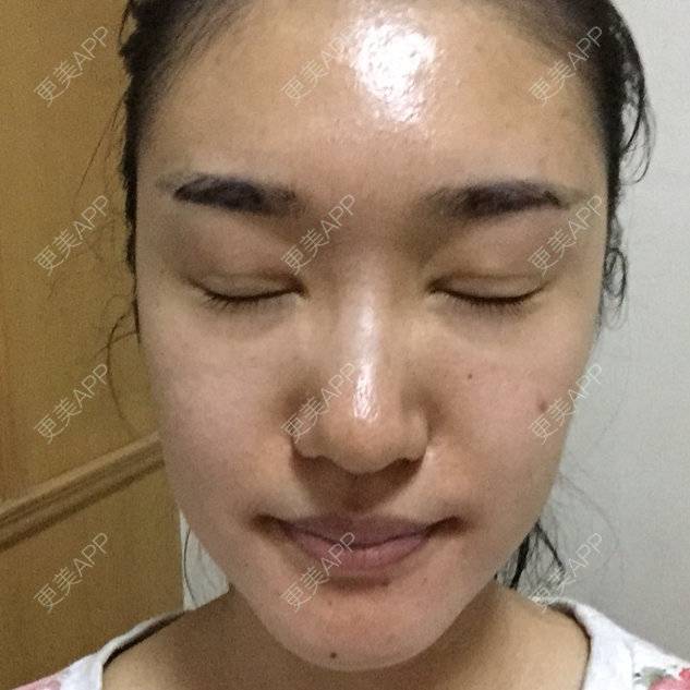 更美 - 楿里奈的半永久纹眉经验 | 北京 | 眼部整形 | 半永久纹眉 | 绣眉 | 美购日记