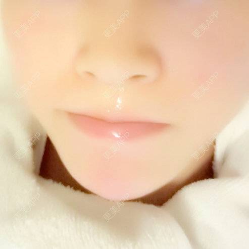 更美 - 更美用户7237075443的水光项目经验 | 水光项目 | 德阳