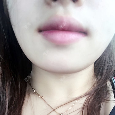 变美之路