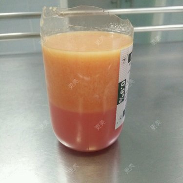 纯脂肪呀油坨坨的大腿内侧抽出来的