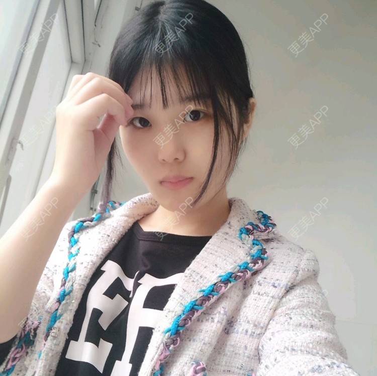 更美 - 洋洋啊的经验 | 硅胶隆鼻 | 鼻部整形圈 | 隆鼻 | 武汉