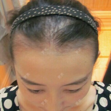 杨志祥 医生