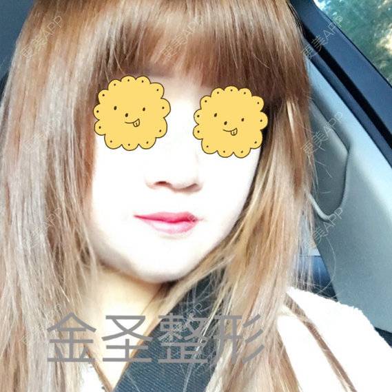 更美 - 北京金圣医疗美容的经验 | 北京