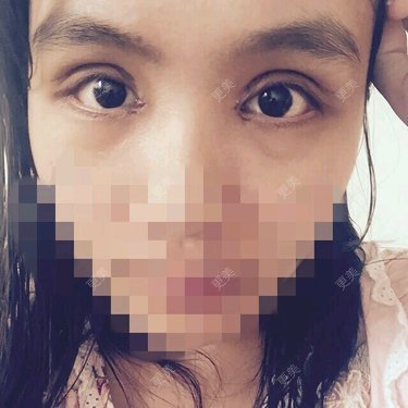 乐观的糖糖