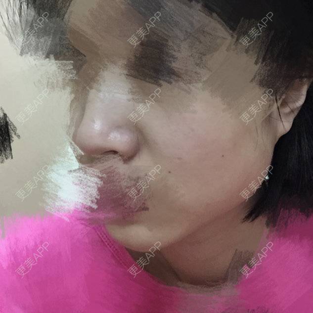 更美 - 大萌萌一点都不萌的经验 | 下颌角 | 刘剑锋 | 北京