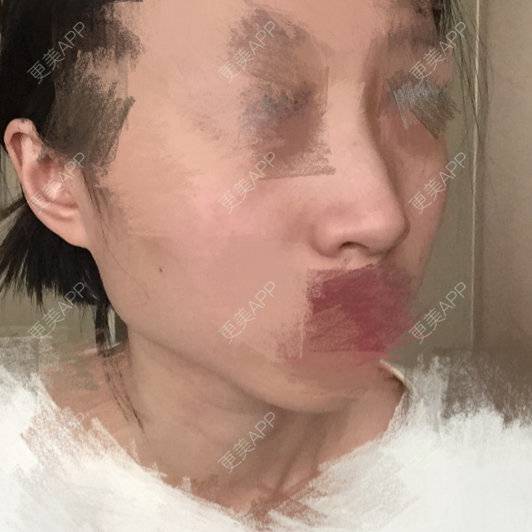 更美 - 大萌萌一点都不萌的经验 | 下颌角 | 刘剑锋 | 北京