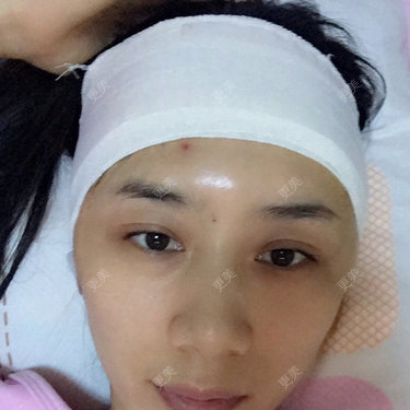 小林最近