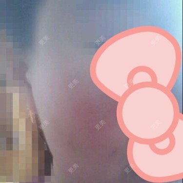 lllyyynnn