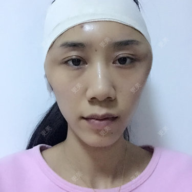 小林最近