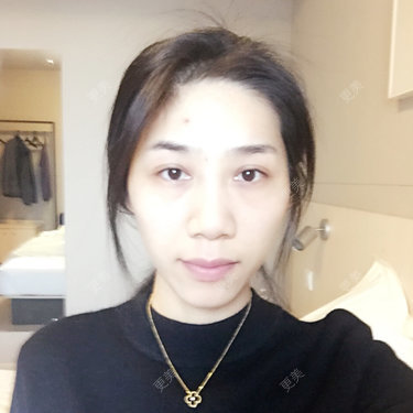 小林最近