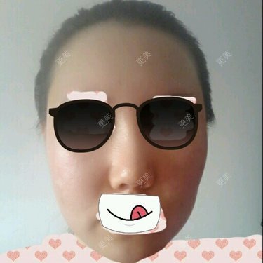 lllyyynnn