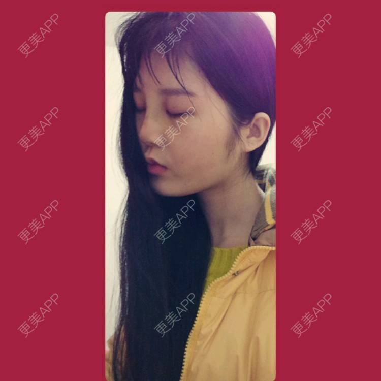 更美 - 洋洋啊的经验 | 隆鼻 | 硅胶隆鼻 | 武汉