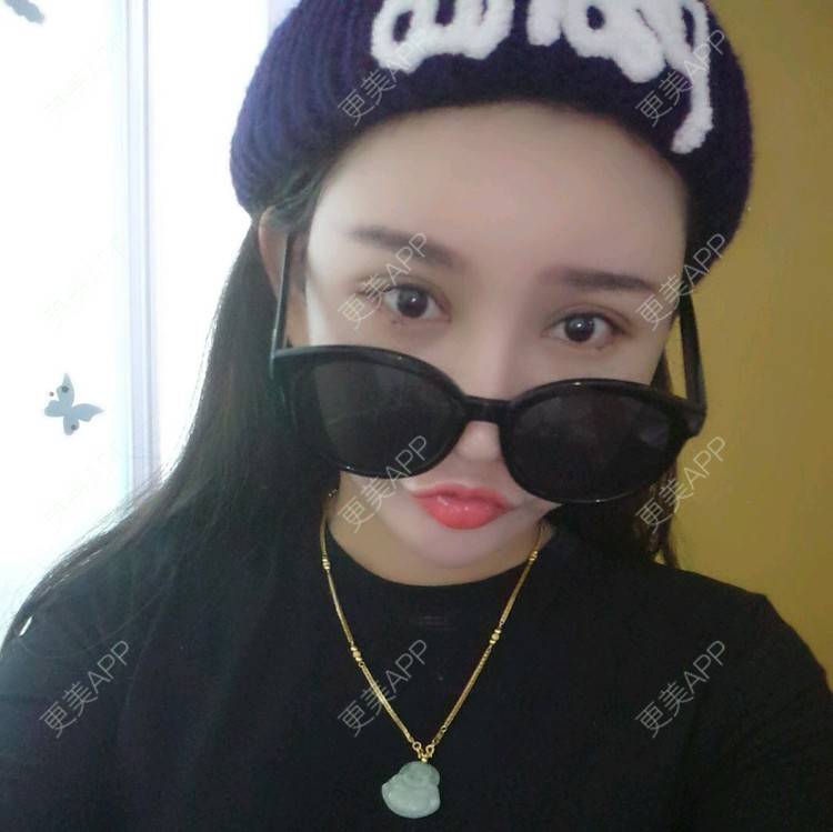 更美 - 茶色 💋•࿐的经验 | 眼睛 | 切开外眼角