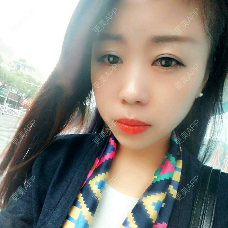 更美 - 悔恨不已的经验 | 全切双眼皮 | 绍兴