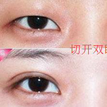 崔剑 医生