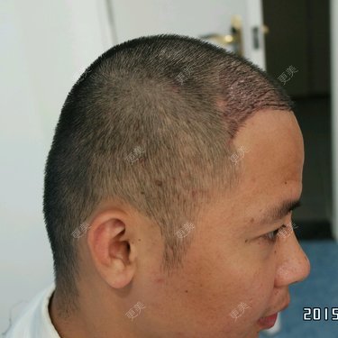 曾浩 医生