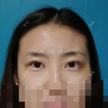 清泉石上游