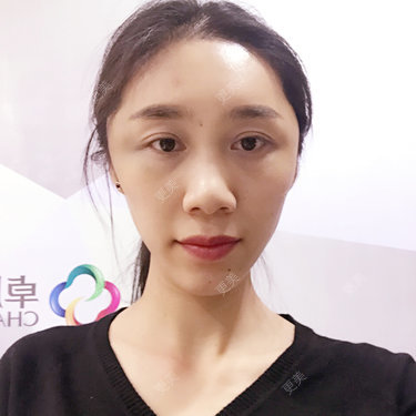 小林最近