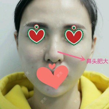 黄普利 医生