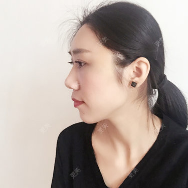 小林最近
