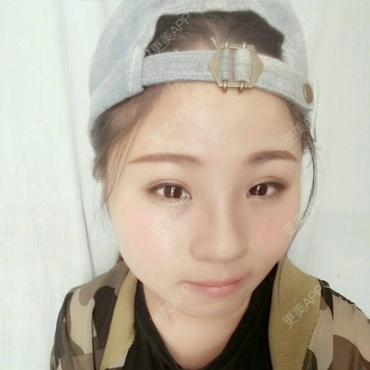 更美 - 变美的路上真心累的经验 | 太阳穴