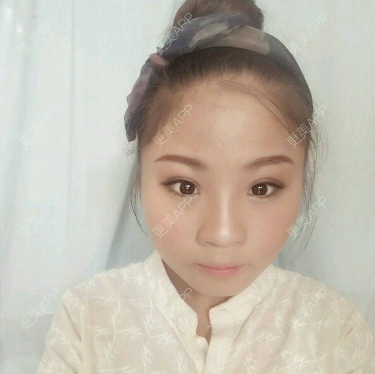 更美 - 变美的路上真心累的经验 | 太阳穴