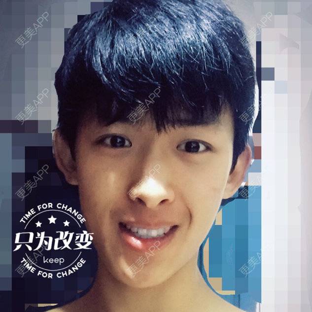更美 - 李欣111的经验 | 耳部矫正 | 乌鲁木齐