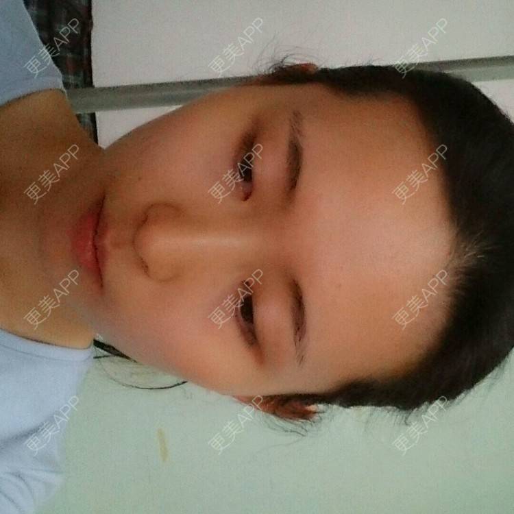 更美 - 更美用户4QhDAnWWJk的经验 | 太阳穴 | 武汉