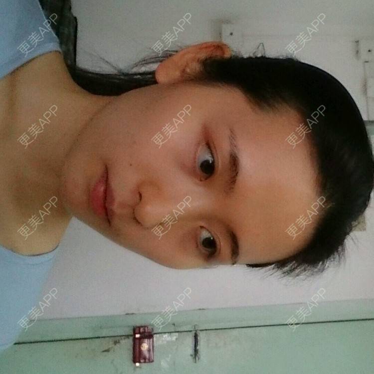 更美 - 更美用户4QhDAnWWJk的经验 | 太阳穴 | 武汉