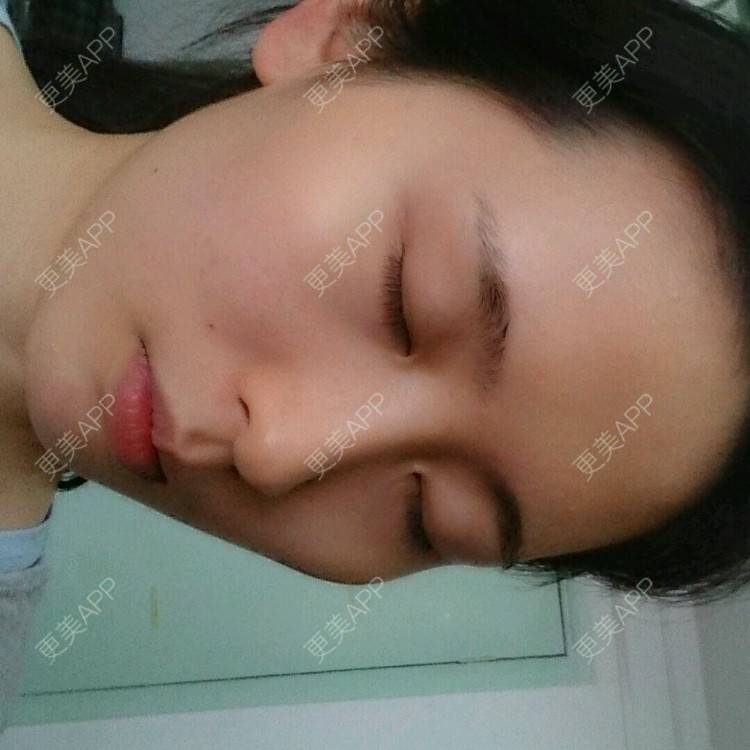 更美 - 更美用户4QhDAnWWJk的经验 | 太阳穴 | 武汉