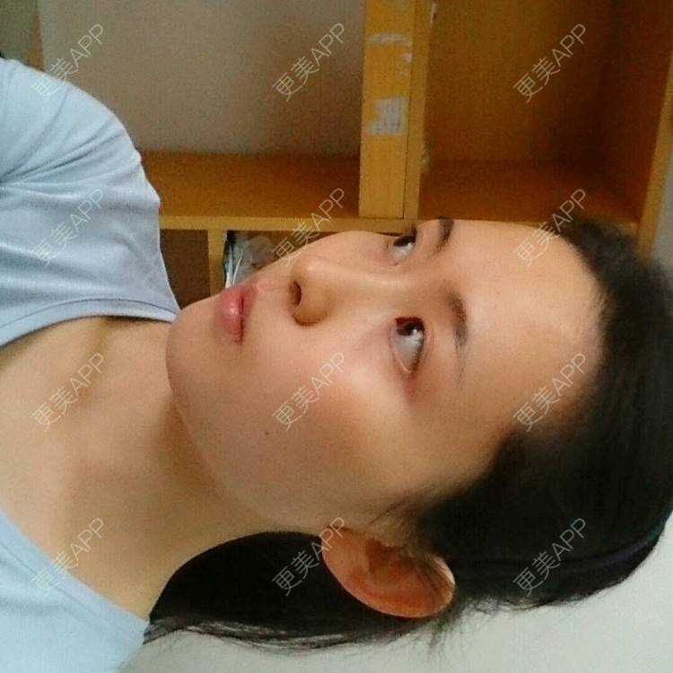 更美 - 更美用户4QhDAnWWJk的经验 | 太阳穴 | 武汉