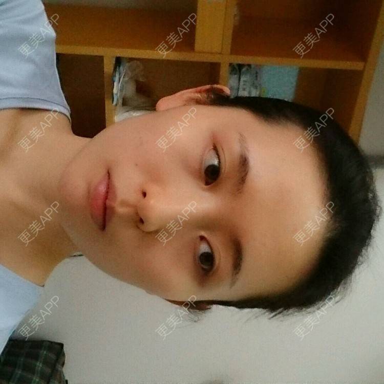 更美 - 更美用户4QhDAnWWJk的经验 | 太阳穴 | 武汉