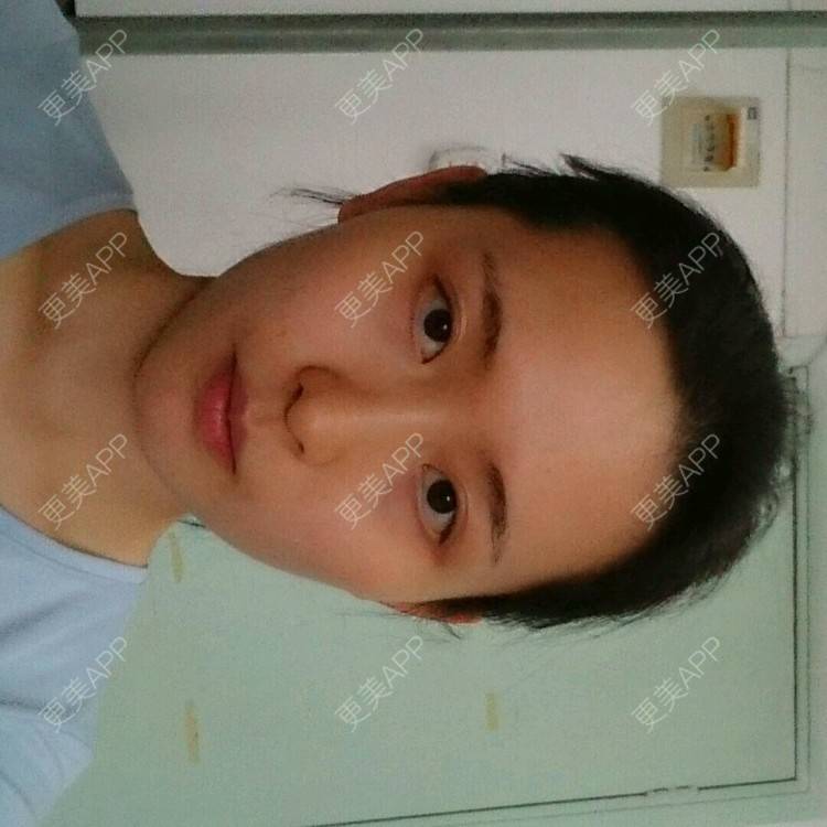 更美 - 更美用户4QhDAnWWJk的经验 | 太阳穴 | 武汉