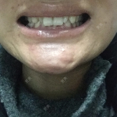 更美用户9ItXKx0mgk