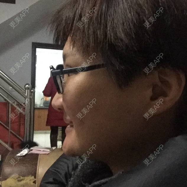 更美 - 更美用户9ItXKx0mgk的经验 | 牙齿治疗