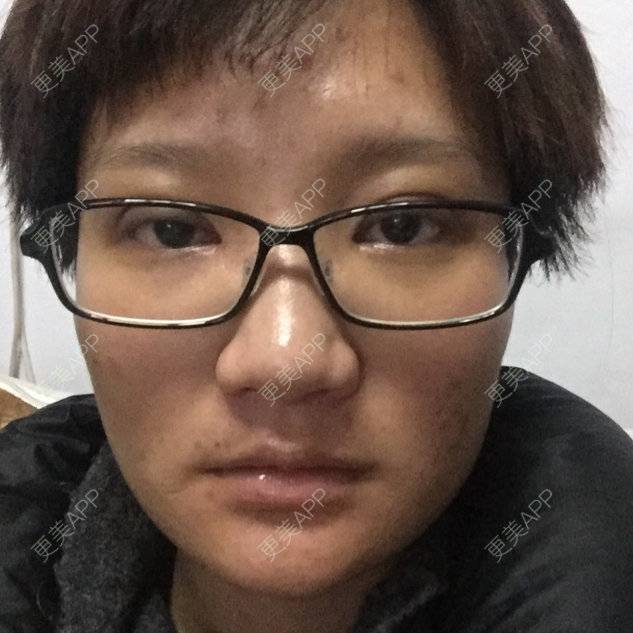 更美 - 更美用户9ItXKx0mgk的经验 | 牙齿治疗