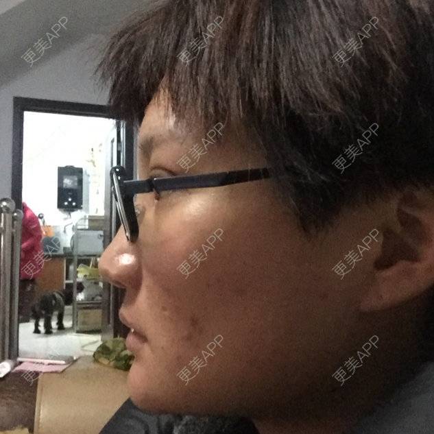 更美 - 更美用户9ItXKx0mgk的经验 | 牙齿治疗